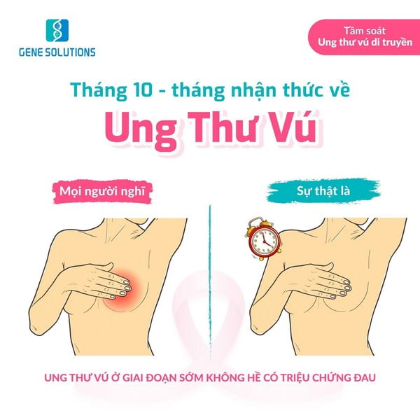 cách phát hiện ung thư vú sớm 3