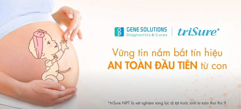 Xét nghiệm hội chứng Down có thể làm từ rất sớm 2