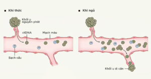 Tế bào ung thư vú hoạt động khi con người đang say giấc 3