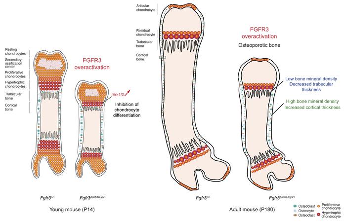 Loạn sản sụn Hypochondroplasia 1