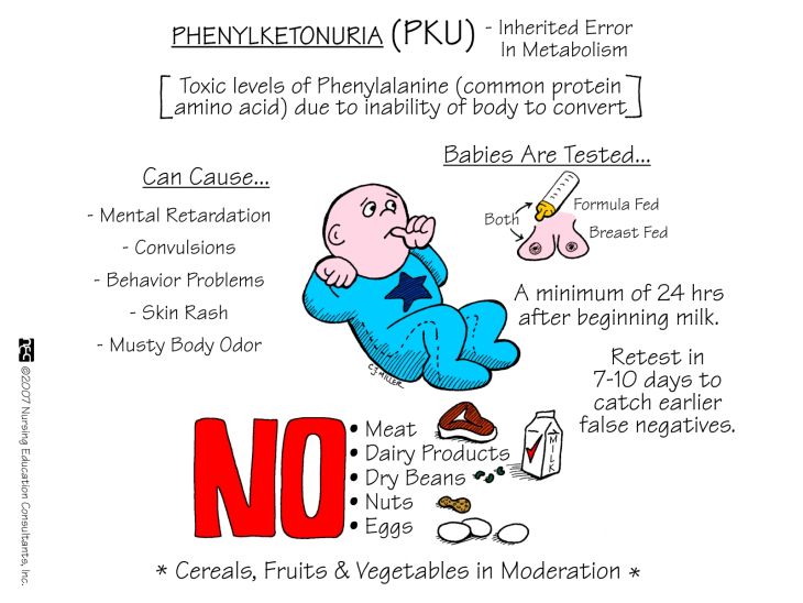 Phenylketon niệu (PKU) 1