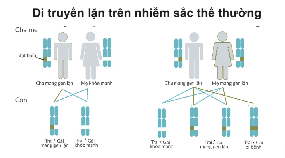 Phenylketon niệu (PKU) 11