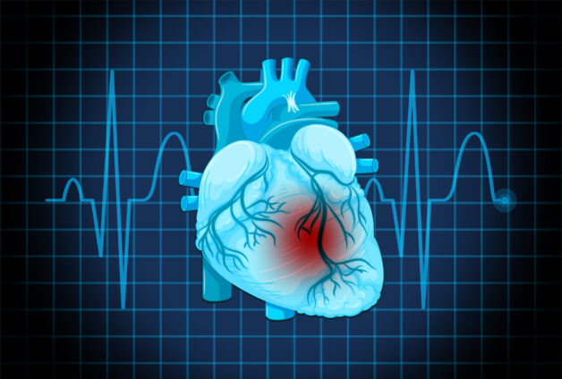 Hội chứng Cardiofaciocutaneous 3