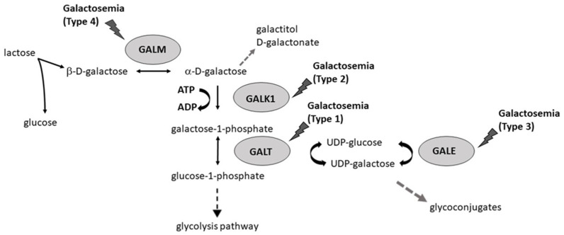 Rối loạn chuyển hóa đường galactose (Galactosemia) 5