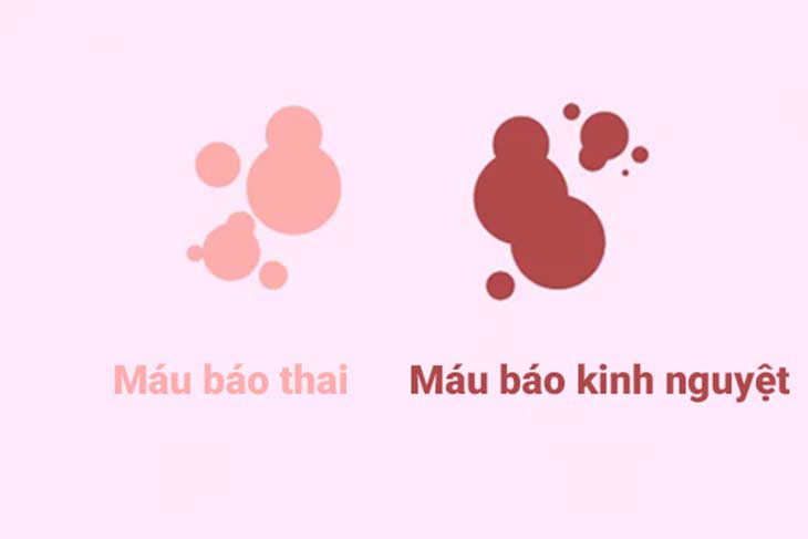 Ra máu đỏ tươi khi mang thai tháng đầu: Khi nào mới đáng lo? 1