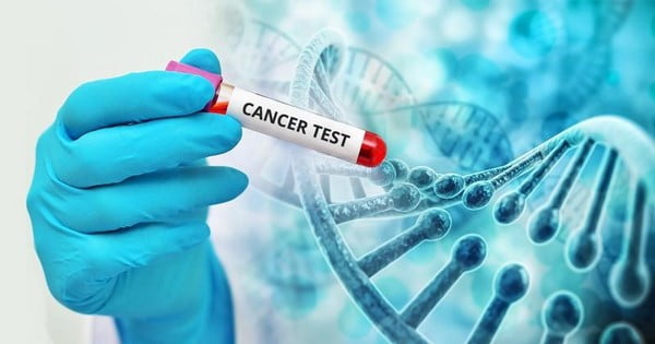 xét nghiệm máu phát hiện ung thư vú 3