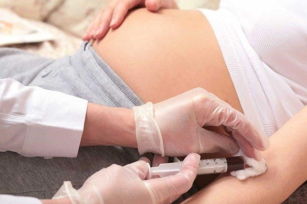 kiểm tra dị tật thai nhi tuần thứ 12
