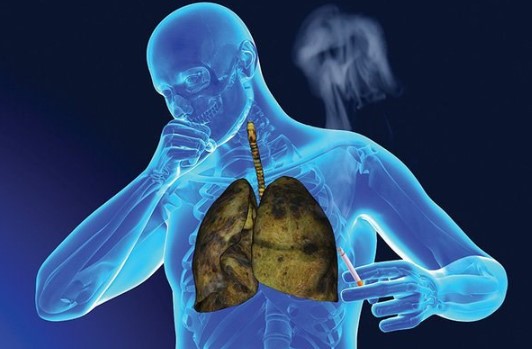 ung thư phổi dấu hiệu nhận biết bệnh