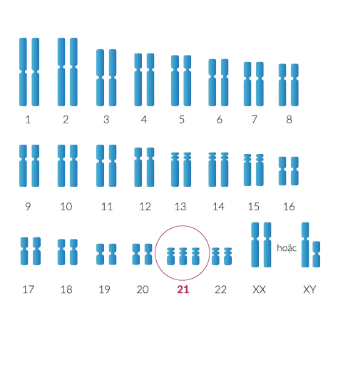 Sàng lọc toàn diện các bất thường di truyền phổ biến trong thai kỳ – triSure Procare NIPT 4