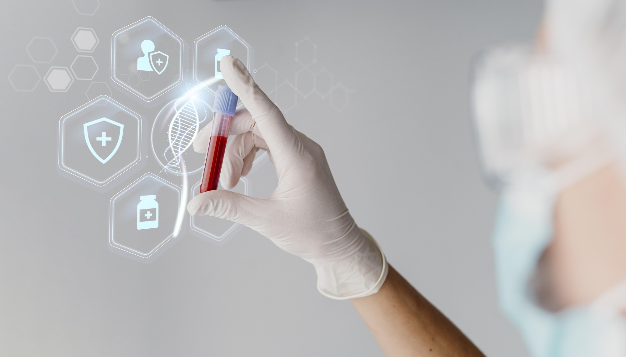 Lựa chọn gói tầm soát ung thư nào để phát hiện bệnh sớm? 2 Xét nghiệm ctDNA giúp phát hiện DNA ngoại bào lưu hành trong máu