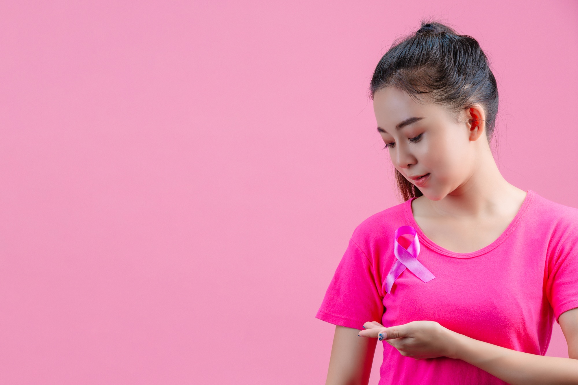 Ung thư vú là một trong những loại ung thư phổ biến nhất ở nữ giới 