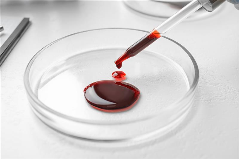 Các xét nghiệm ctDNA thường được thực hiện thông qua mẫu máu
