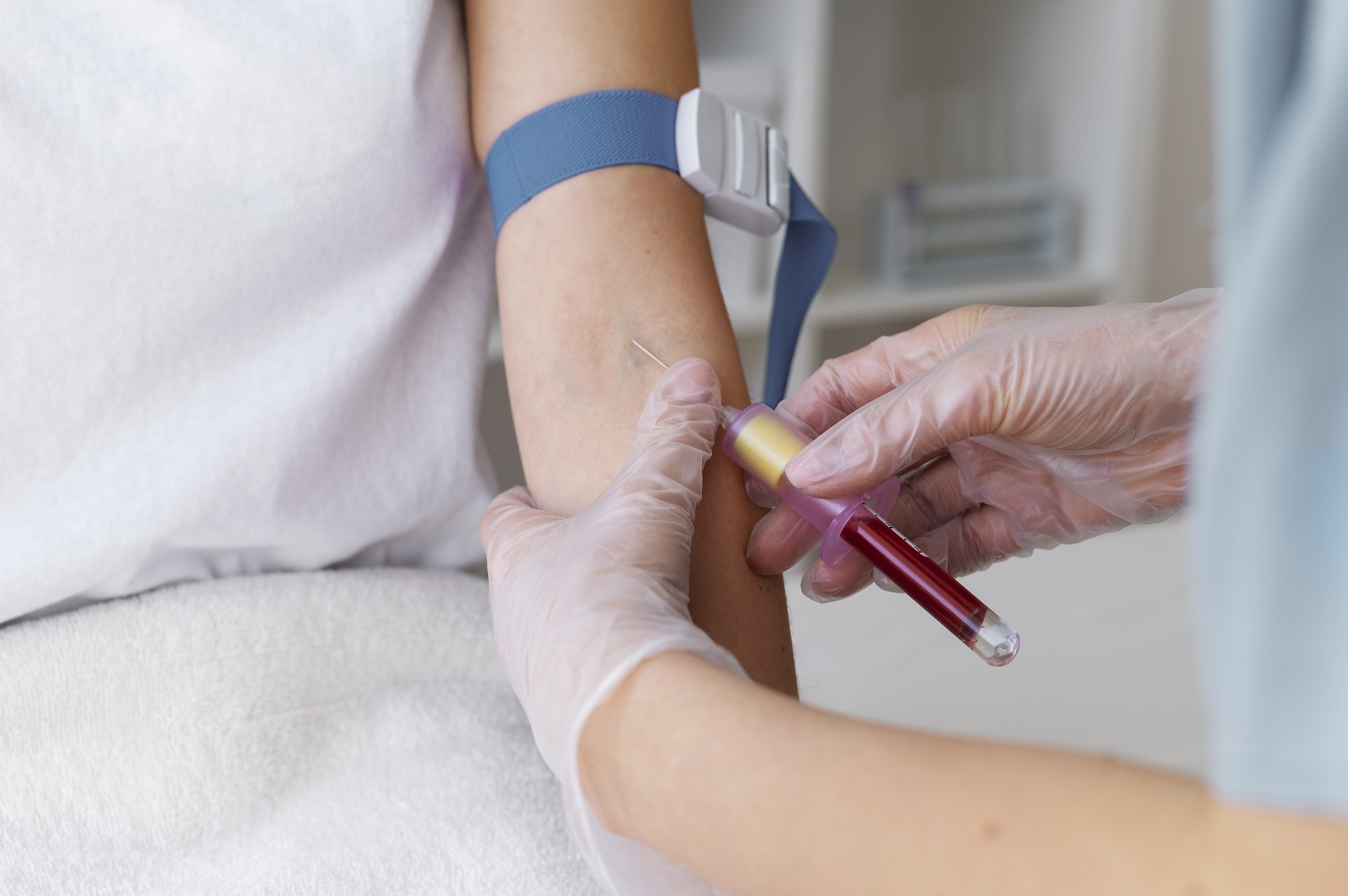 Nguyên nhân ung thư cổ tử cung: Các yếu tố nguy cơ và phương pháp sàng lọc 4 Xét nghiệm ctDNA được thực hiện thông qua xét nghiệm máu