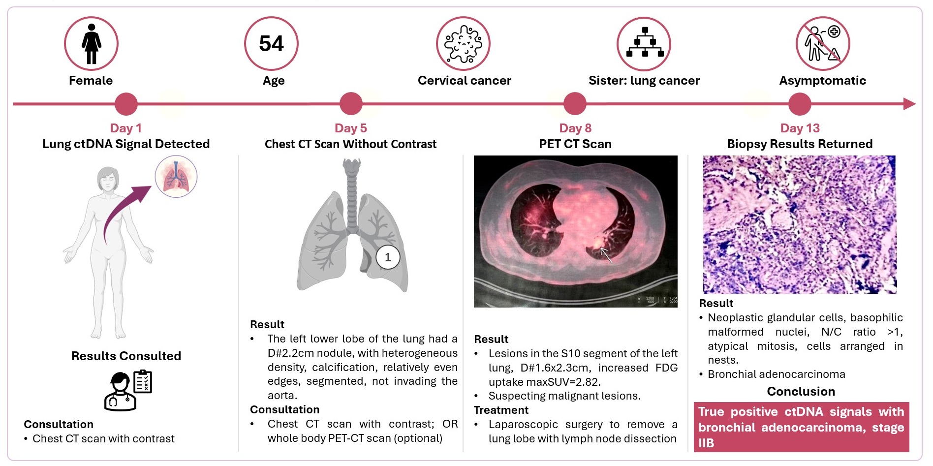 Hình ảnh trích từ báo cáo: Case study nữ, 54 tuổi, không triệu chứng, xét nghiệm ctDNA phát hiện tín hiệu ung thư
