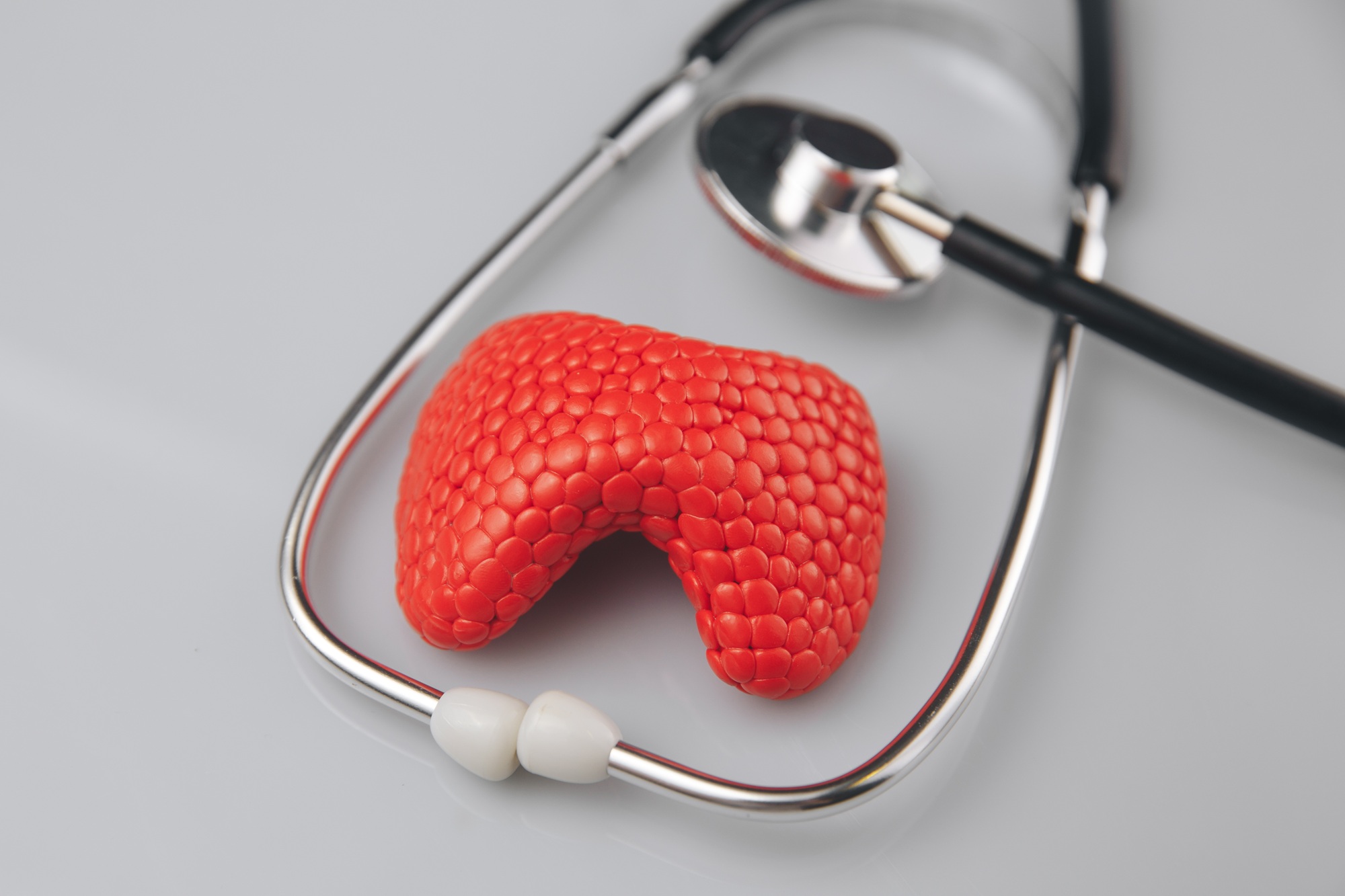 Ung thư tuyến giáp là bệnh lý ác tính xuất phát từ các tế bào trong tuyến giáp