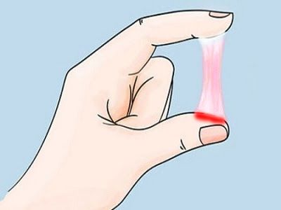 Khí hư bất thường là 1 trong 10 dấu hiệu ung thư cổ tử cung