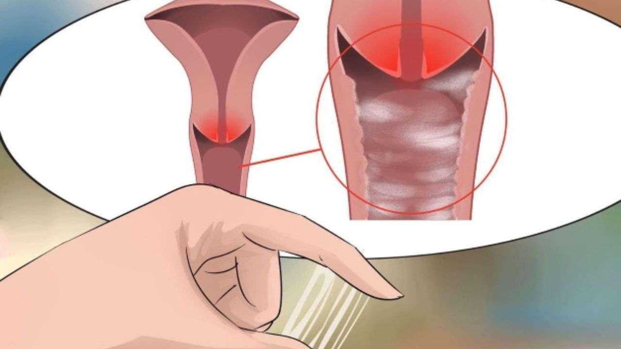 Những bệnh phụ khoa thường gặp: Nhận biết sớm để bảo vệ sức khỏe 1