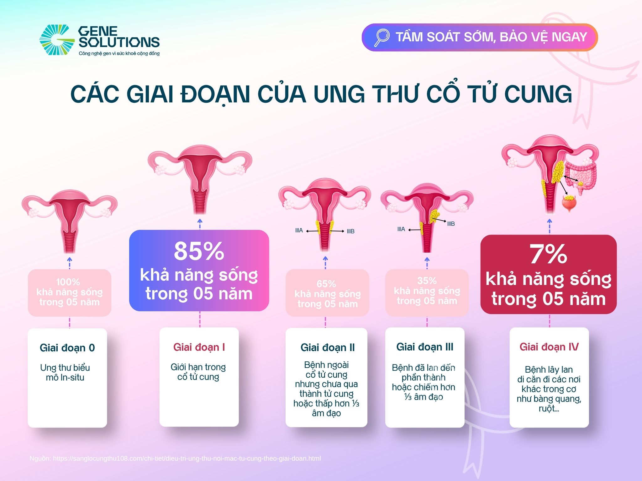 Ở giai đoạn 1 ung thư nội mạc tử cung tiên lượng sống là trên 85% 