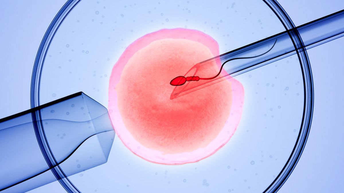 Bố mẹ mang gen bệnh teo cơ tủy sống nên cân nhắc phương pháp IVF kết hợp PGT-M