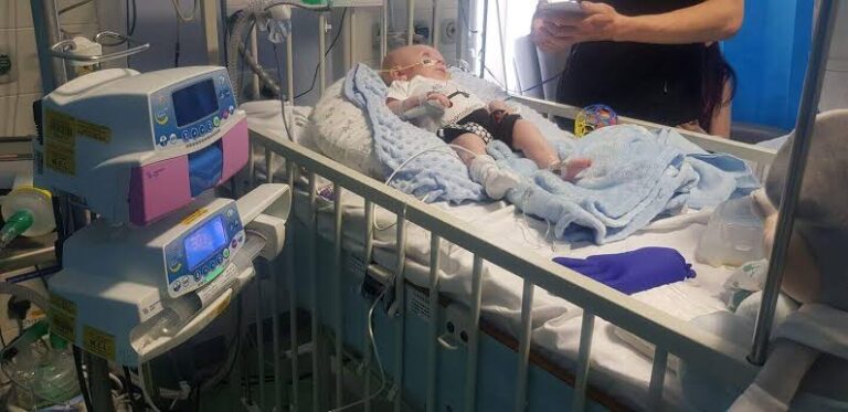 Các type bệnh teo cơ tủy sống SMA: Đặc điểm, triệu chứng và tiên lượng