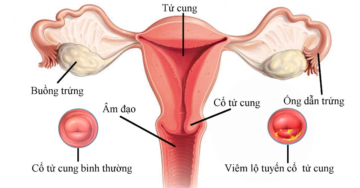 Chảy máu âm đạo bất thường có nguy hiểm không? Những dấu hiệu không nên chủ quan 3