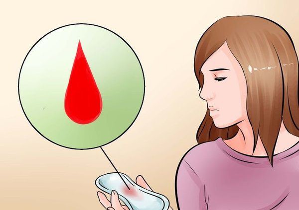 Chảy máu âm đạo bất thường: Nguyên nhân, triệu chứng và cách xử trí an toàn