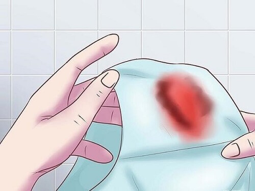 Chảy máu sau khi quan hệ