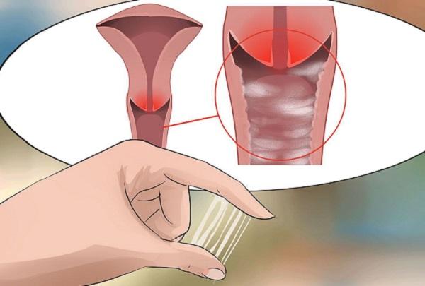 Khí hư có mùi hôi có nguy hiểm không? 7 nguyên nhân phụ nữ không nên bỏ qua 1