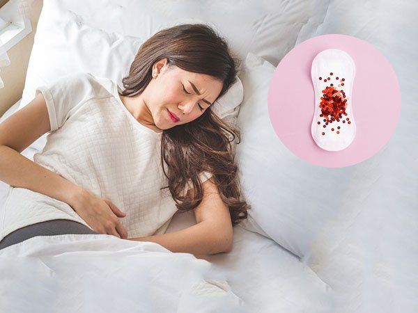 Kinh nguyệt ra nhiều máu cục có nguy hiểm không? Dấu hiệu cảnh báo bệnh phụ khoa cần lưu ý 1