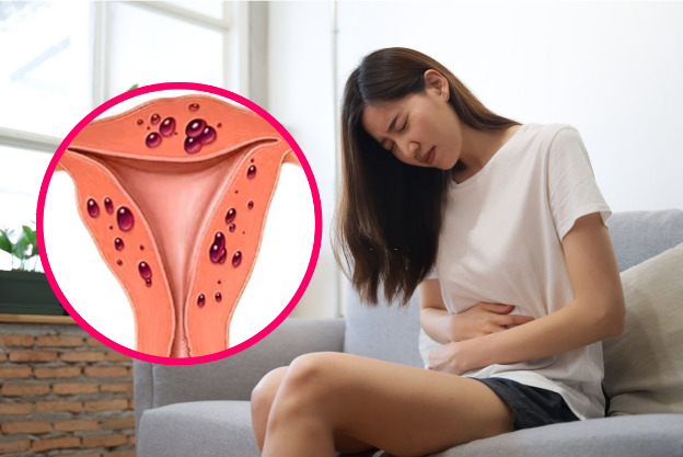 Ra máu giữa kỳ kinh