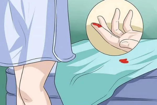 Ra máu sau quan hệ có phải ung thư không? Nguyên nhân và giải pháp tầm soát hiện đại
