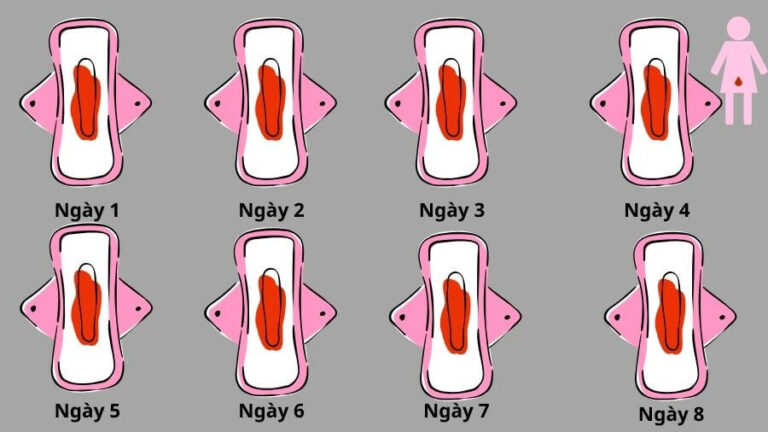Rong kinh kéo dài là bệnh gì? 7 nguyên nhân thường gặp và khi nào cần đi khám?