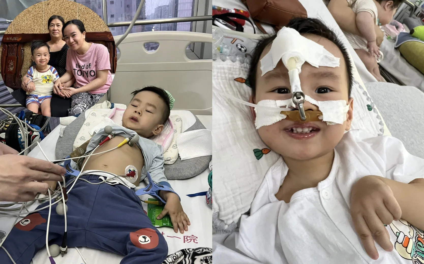 Bé Zin được phát hiện bệnh SMA khi 10 tháng tuổi (Ảnh: Báo Thanh Niên)