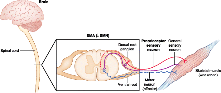 Cơ chế gây bệnh teo cơ tủy sống SMA