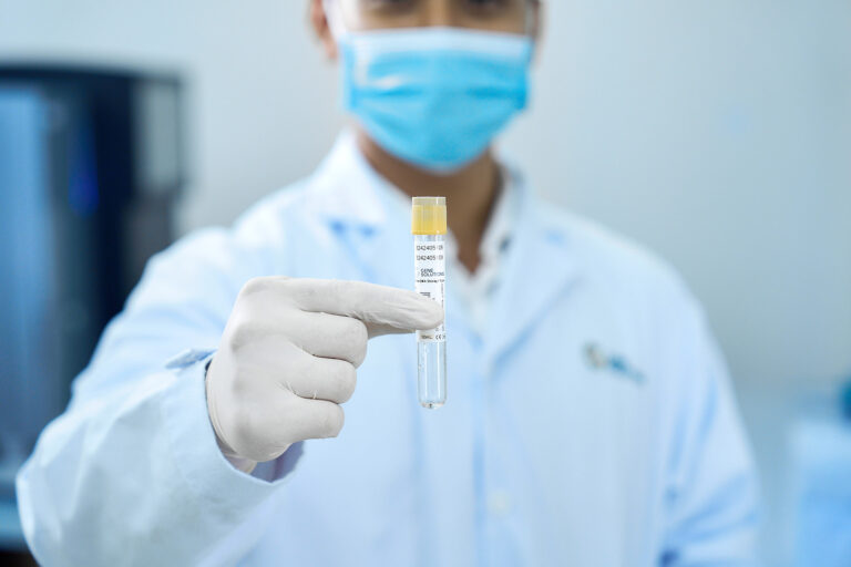 Xét nghiệm teo cơ tủy sống SMA: Các phương pháp sàng lọc và chẩn đoán hiện nay