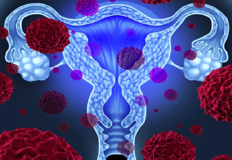 Giải mã thắc mắc HPV tuýp 18 có gây ung thư cổ tử cung không?