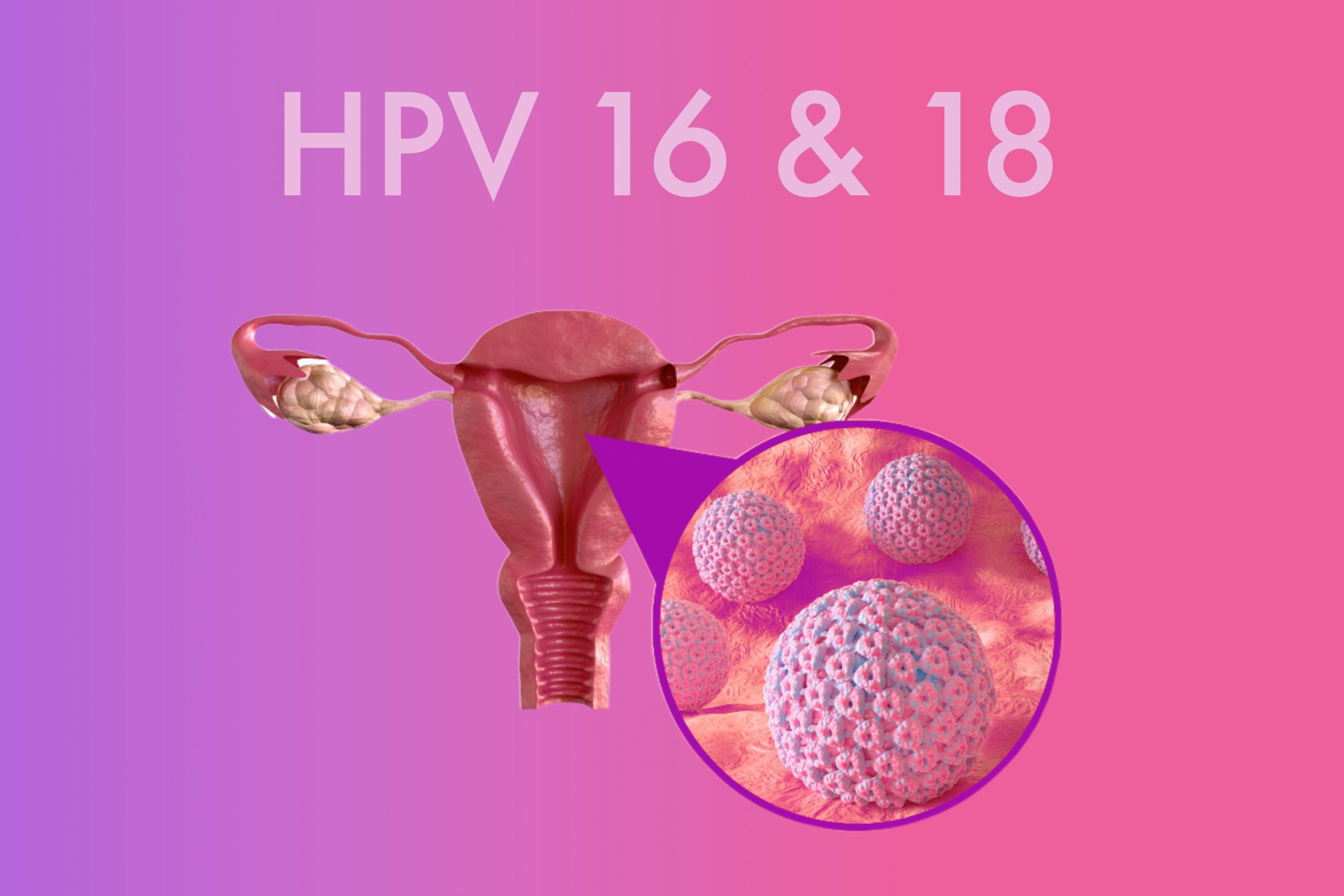 HPV 16 và HPV 18 là một trong số những nguyên nhân phổ biến nhất gây ung thư cổ tử cung