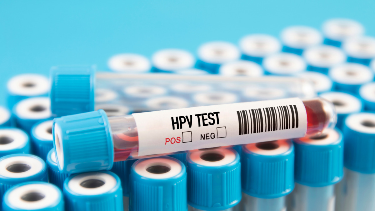 Hình ảnh minh họa cho HPV Test