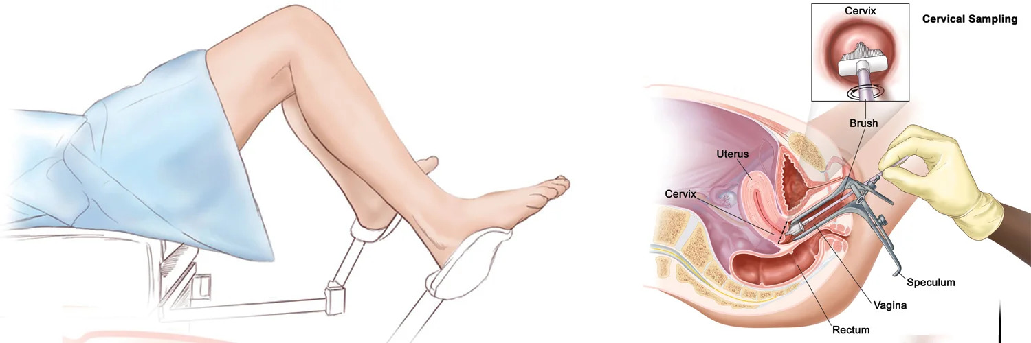 Hình ảnh minh họa cho phương pháp Pap smear