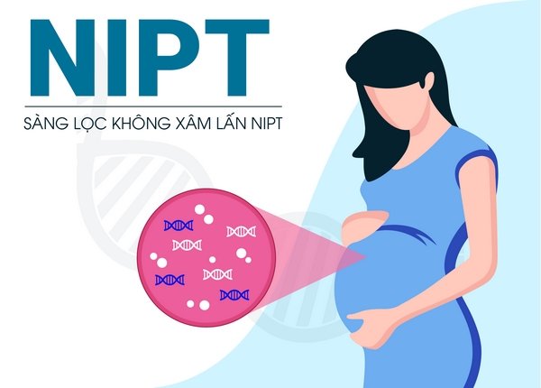NIPT là xét nghiệm sàng lọc trước sinh không xâm lấn