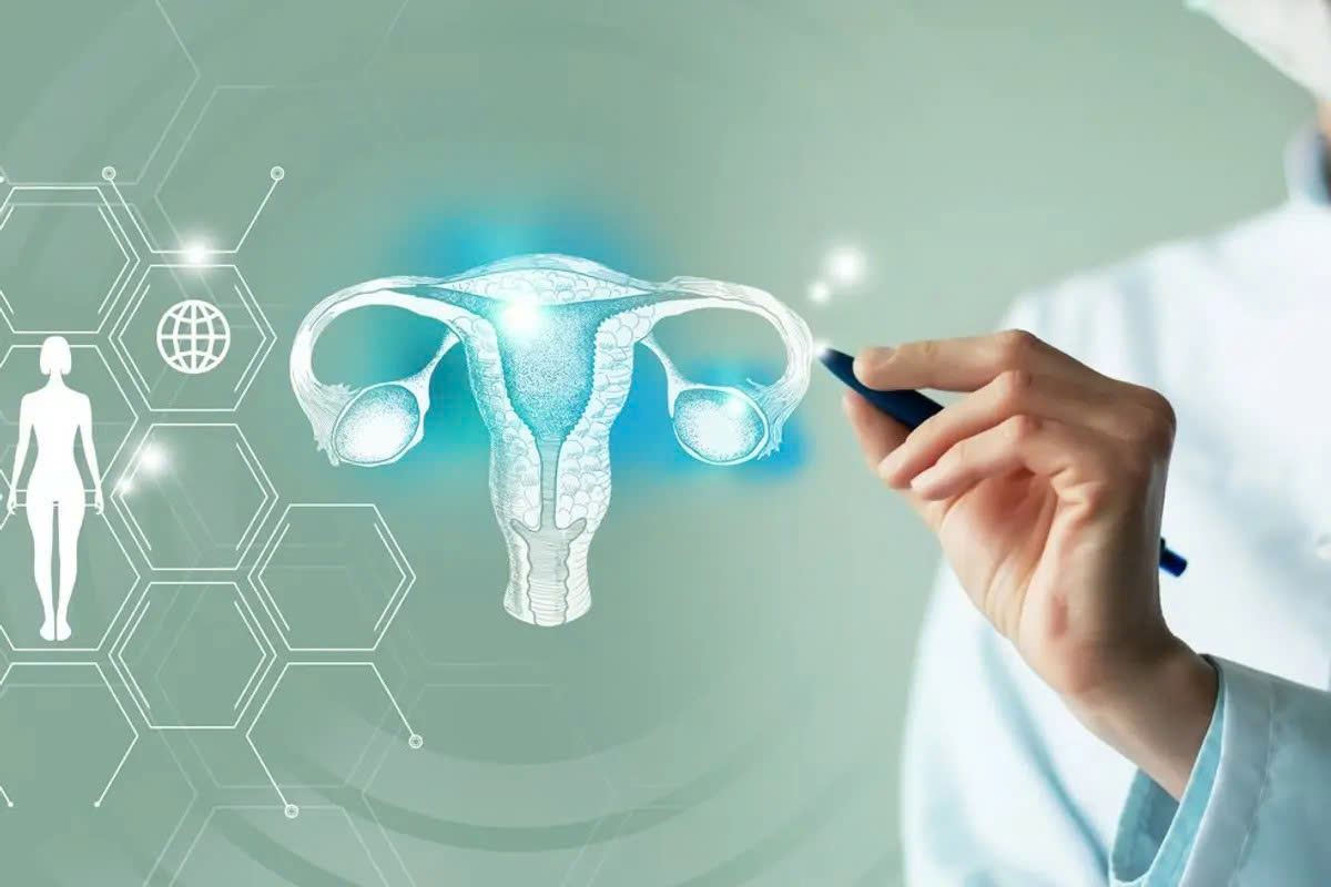 Nang buồng trứng có phải ung thư không? Cách phân biệt và khi nào cần đi khám 4 Nang buồng trứng có phải ung thư không? Cách phân biệt và khi nào cần đi khám 3