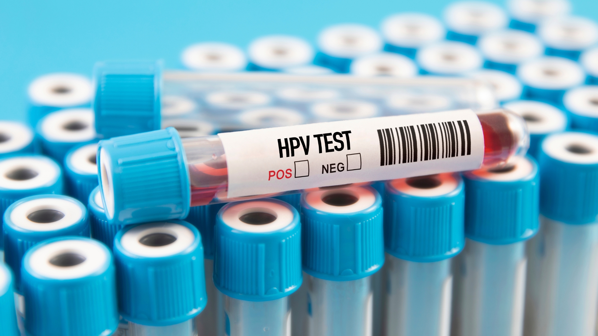 Xét nghiệm HPV giúp phát hiện và định type virus HPV