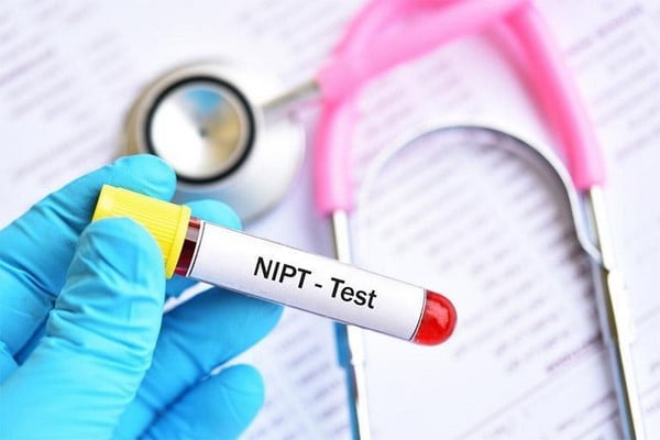 NIPT dương tính là gì? Những điều thai phụ cần làm sau khi nhận kết quả