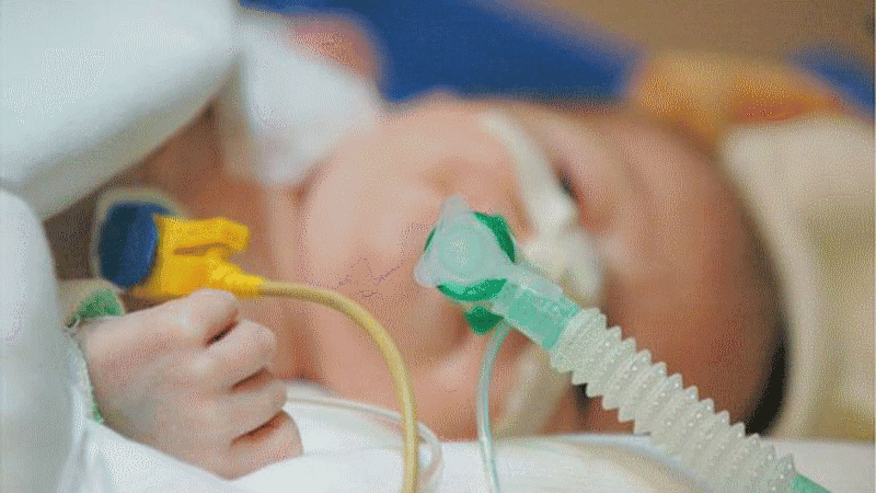 Chăm sóc trẻ bị suy hô hấp như thế nào?